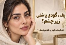 زیر چشمتان پف دارد، گود شده یا پوستش شل شده؛ اندولیفت بهتر است یا فیلر و بلفاروپلاستی؟