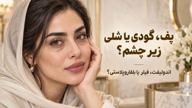 زیر چشمتان پف دارد، گود شده یا پوستش شل شده؛ اندولیفت بهتر است یا فیلر و بلفاروپلاستی؟